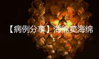 【病例分享】海綿竇海綿狀血管瘤