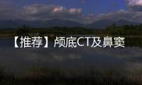 【推薦】顱底CT及鼻竇軸冠矢解剖圖