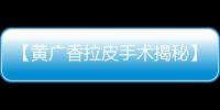 【黃廣香拉皮手術揭秘】告訴你黃廣香做第五代拉皮手術可以年輕幾歲？