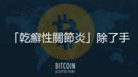 「乾癬性關節炎」除了手肘和腳踝，也可能發生在阿基里斯腱