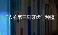 “人的第三副牙齒”種植牙究竟貴在哪、亂象有哪些？