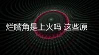 爛嘴角是上火嗎 這些原因更要重視