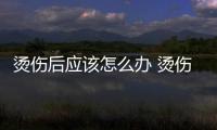 燙傷后應該怎么辦 燙傷后可擦新鮮蘆薈嗎