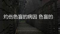 灼傷色盲的病因 色盲的臨床表現