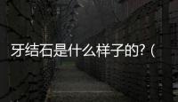 牙結(jié)石是什么樣子的?（牙結(jié)石是什么樣子的）