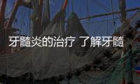 牙髓炎的治療 了解牙髓炎的癥狀