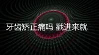 牙齒矯正痛嗎 戳進來就告訴你
