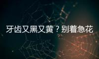 牙齒又黑又黃？別著急花錢洗牙，用7個“土方”輕松白回來