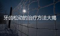 牙齒松動的治療方法大揭秘