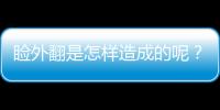 瞼外翻是怎樣造成的呢？
