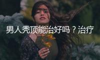 男人禿頂能治好嗎？治療禿頂小偏方