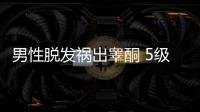 男性脫發禍出睪酮 5級以下可用內服或外用藥物治療