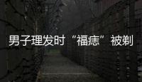男子理發時“福痣”被剃破 醫院檢查后竟是癌前病變