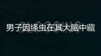 男子因絳蟲在其大腦中藏匿了數十年 導致其突發癲癇