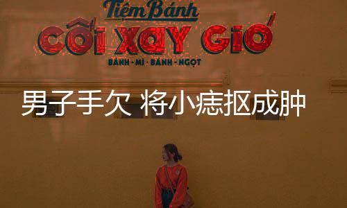男子手欠 將小痣摳成腫瘤