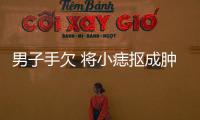男子手欠 將小痣摳成腫瘤