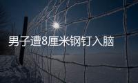 男子遭8厘米鋼釘入腦 奇跡生還