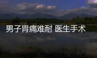 男子胃痛難耐 醫生手術從胃里取出異物！結果竟是一部手機