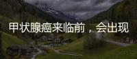 甲狀腺癌來臨前，會(huì)出現(xiàn)4種“現(xiàn)象”，能發(fā)現(xiàn)的人很幸運(yùn)！