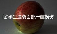留學生遇襲面部嚴重損傷！我領館緊急提醒