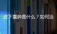 皮下囊腫是什么？如何治療？