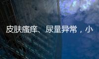 皮膚瘙癢、尿量異常，小心是腎病，6個癥狀觀察對照