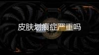 皮膚劃痕癥嚴重嗎