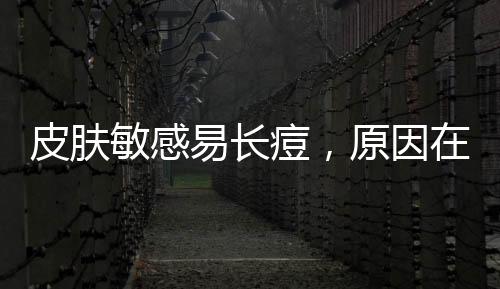 皮膚敏感易長痘，原因在于女生不恰當的護理