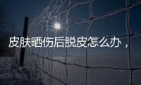 皮膚曬傷后脫皮怎么辦，皮膚曬傷后四個