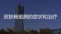 皮膚蠅蛆病的癥狀和治療方法（詳解皮膚蠅蛆病的預(yù)防和治療）