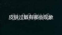 皮膚過敏有哪些現象