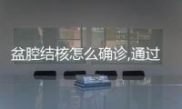 盆腔結(jié)核怎么確診,通過(guò)超聲和這3點(diǎn)表現(xiàn)即可確診