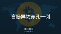 盲腸異物穿孔一例