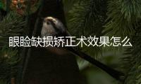 眼瞼缺損矯正術效果怎么樣？