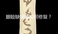 眼瞼缺損該如何修復？