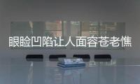 眼瞼凹陷讓人面容蒼老憔悴 千萬不能要