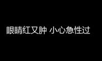 眼睛紅又腫 小心急性過敏性結膜炎找上門