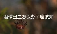眼球出血怎么辦？應該如何處理？
