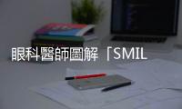 眼科醫(yī)師圖解「SMILE微創(chuàng)近視雷射手術(shù)」，術(shù)前檢查、術(shù)後照顧Step by Step