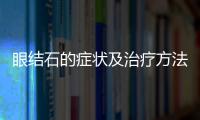 眼結石的癥狀及治療方法是什么 眼底會有小顆粒