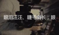 眼淚汪汪、睫毛倒長，眼瞼內翻有哪些癥狀？眼瞼內翻矯正有哪些？