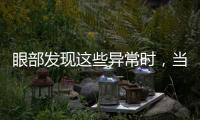 眼部發現這些異常時，當心是腎臟出問題了，建議檢查一下腎臟