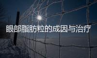 眼部脂肪粒的成因與治療方法（幫你了解和解決眼部脂肪粒問題）