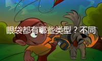 眼袋都有哪些類型？不同的眼袋又該用哪些方法去祛除？