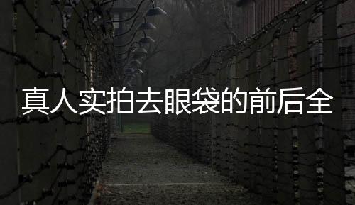 真人實拍去眼袋的前后全歷程