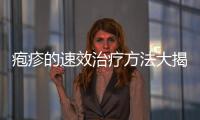 皰疹的速效治療方法大揭秘