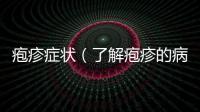 皰疹癥狀（了解皰疹的病理表現(xiàn)和治療方法）