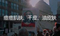 痘痘肌膚、干皮、油皮膚質(zhì)大不同，護膚方法有訣竅
