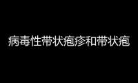 病毒性帶狀皰疹和帶狀皰疹的區(qū)別（病毒性帶狀皰疹）