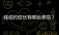 痤瘡的癥狀有哪些表現(xiàn)？